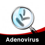 Schema da seguire per il trattamento di Adenovirus in Piccioni
